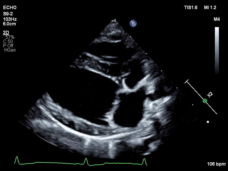echo-website echo-webiste