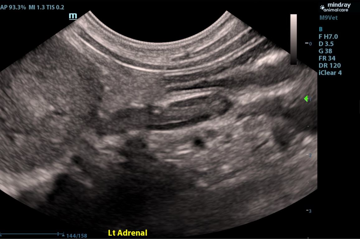 CT scan ultrasound-1