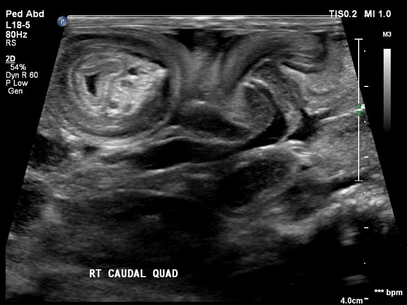 imagining equipment imagining equipment